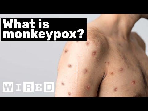 Epidemiologist Answers Common Monkeypox Questions | WIRED