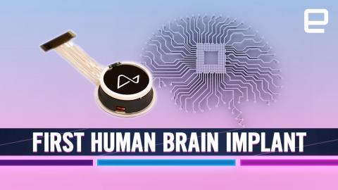 The first human brain implant by Elon Musk’s Neuralink