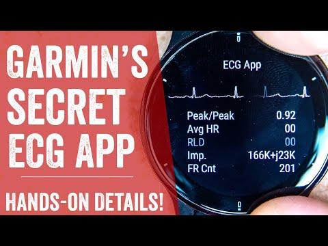 Garmin's Secret ECG Feature & Clinical Trials Detailed