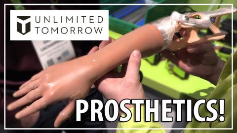 Easton LaChappelle and the Unlimited Tomorrow Prosthetic at CES 2018