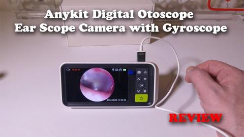 Anykit Digital Otoscope Ear Scope Camera with Gyroscope REVIEW