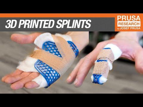 Emergency 3D printed splints guide